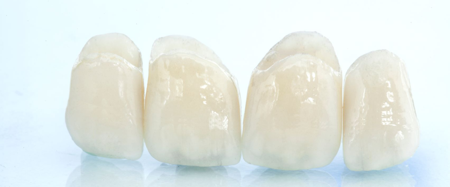 つめ物・かぶせ物