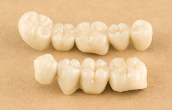 白く自然に仕上げるCAD/CAM冠