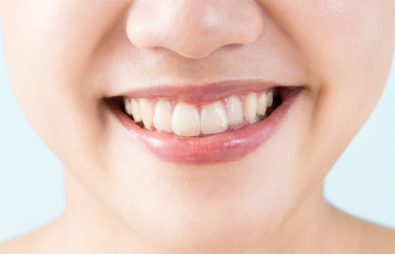 噛み合わせを考えたかぶせ物調整